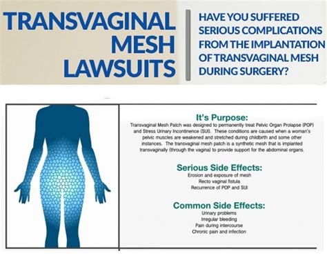 Transvaginal Mesh Lawsuit Tvm Attorney At Help