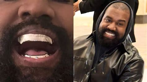 Kanye West Discloses That He Has Erected Titanium Dentures Worth 850k