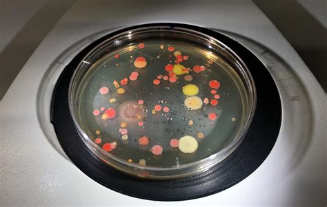 New Bacterial Culture Methods Could Result In The Discovery Of Diverse