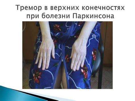Диета при болезнь паркинсона