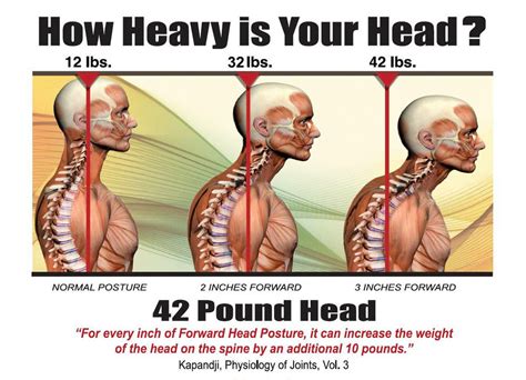 How Heavy Is Your Head Cause Of Neck Pain And Treatment