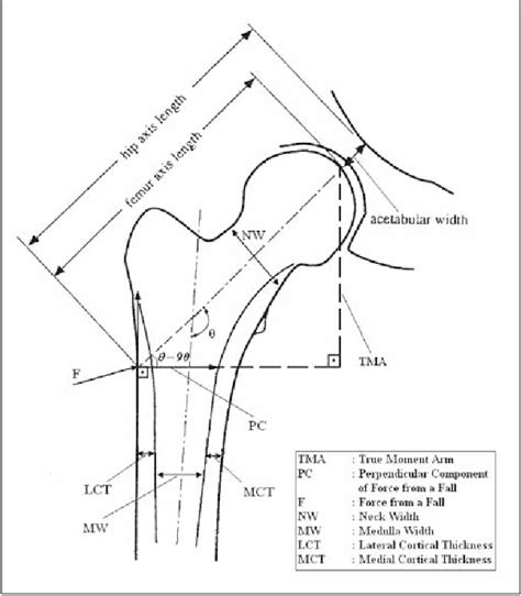 Figure 1 From A New Value Of Proximal Femur Geometry To Evaluate Hip