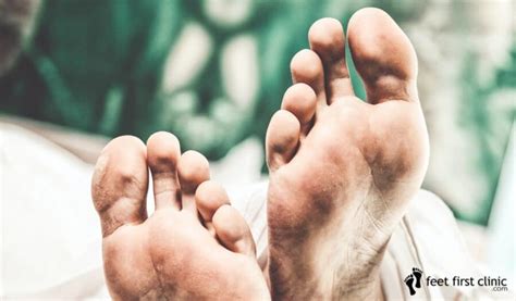 Numb Toes — Causes Symptoms And Fixes Feet First Clinic
