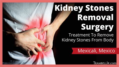 Kidney Stones Removal Surgery Treatment To Remove Kidney Stones From