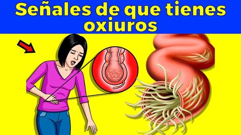 Señales de alarma de que tienes oxiuros parásitos intestinales Saludjk