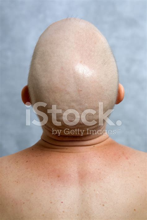 View From Behind Of Womans Bald Head And Bare Shoulders Stock Photo