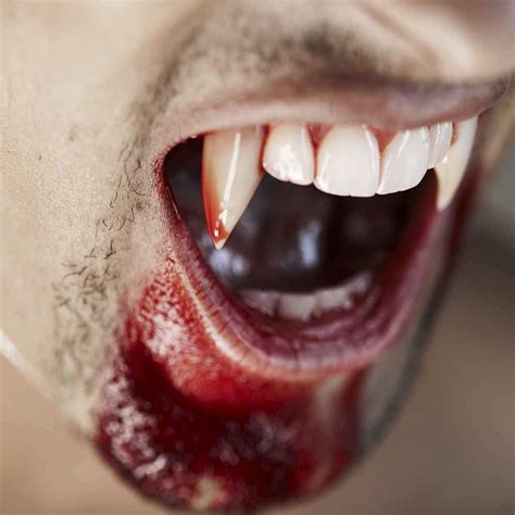 How To Get Vampire Teeth For Real