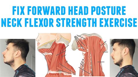 A list of simple tips how to fix a bad posture! Fix forward head posture neck flexor strength wall lean ...