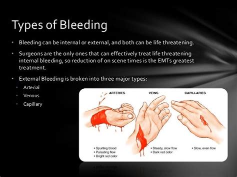 Bls Care For Bleeding And Shock