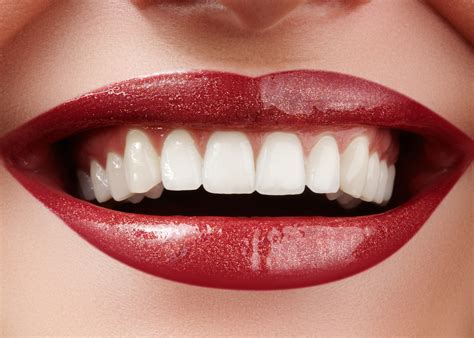 Regency Dental Group Dental Veneers Giving Everyone The Perfect Smile