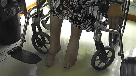 Delightful Polio Goddess Paralysed Legs And Feet