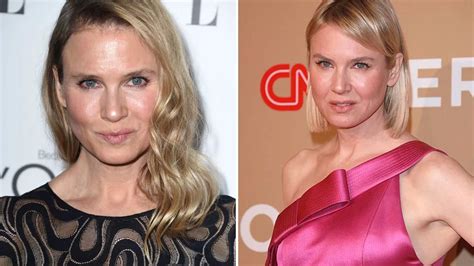 Renee Zellweger Blasts Back After Plastic Surgery Claims I Did Not