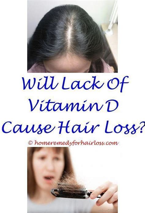How To Stop Hair Loss Due To Lupus