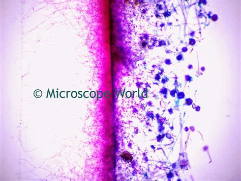 Microscope World Blog Mold Under The Microscope