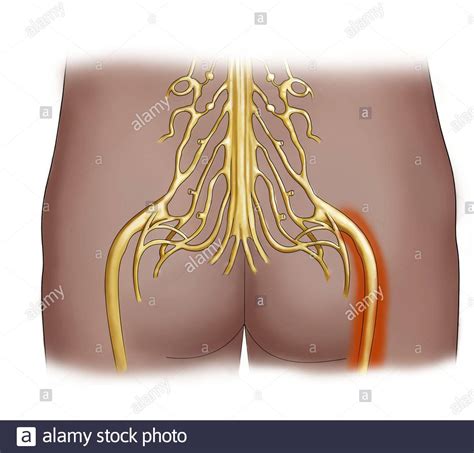 Sciatic Nerve Pain High Resolution Stock Photography And Images Alamy