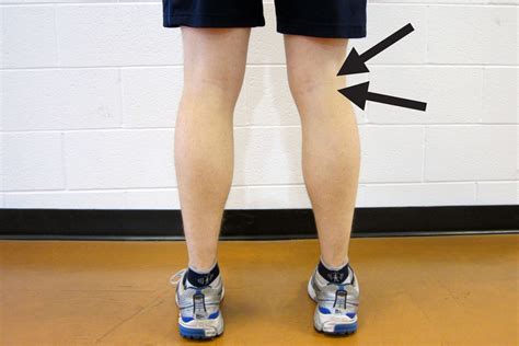 Почему худеет нога после травмы колена фото презентация