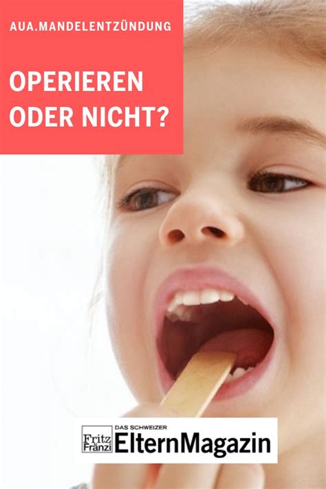 Bitte beachten sie unbedingt unsere verhaltenstipps nach mandelentfernung. Entzündete Mandeln - operieren oder abwarten? | Kinder ...