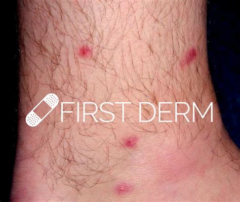 First Derm Allergy Guide