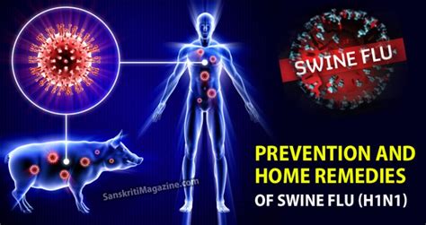 Prevention And Home Remedies Of Swine Flu H1n1