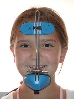 Protraction Headgear Orthodontic Ortodoncia Odontolog A Odontopediatria