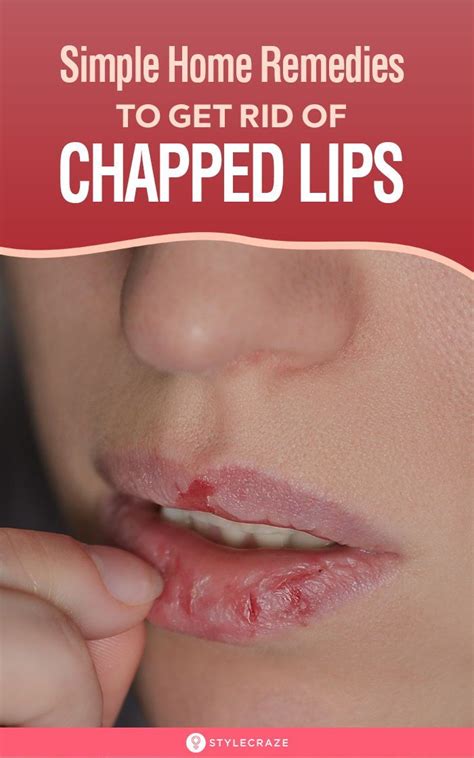 10 Simple Home Remedies To Get Rid Of Chapped Lips Water Is An Essential Part Of Any Beauty