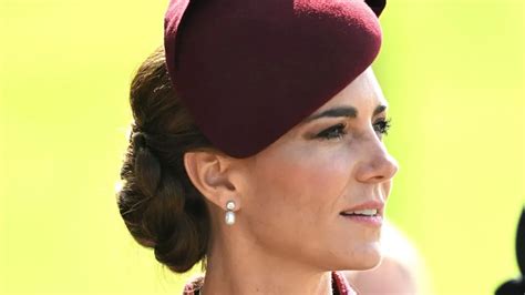 Kate Middleton Obligada A Una Larga Convalecencia La Princesa De