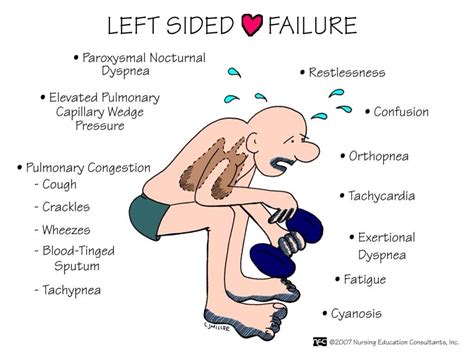 Left Sided Heart Failure Guide Nursing Helpful Tip Medicine Pinterest