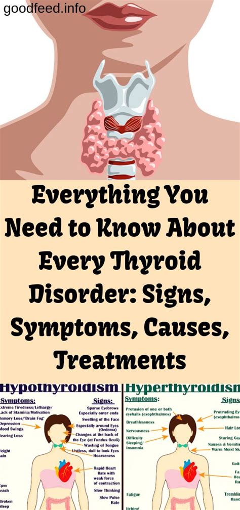 Everything You Need To Know About Every Thyroid Disorder Signs