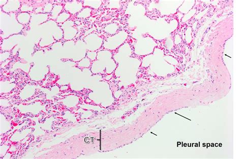 Lung Histology Visceral Pleura Histology Slide Photos