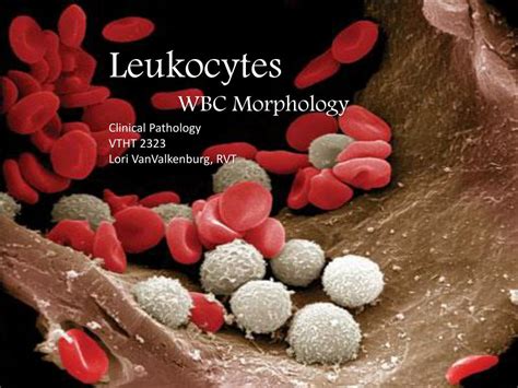 Ppt Leukocytes Wbc Morphology Clinical Pathology Vtht 2323 Lori