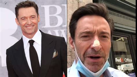 Hugh Jackman Gets Skin Biopsy After Doctors Spotted Something