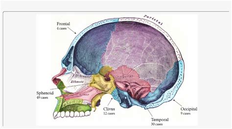 Diagrammatic Representation Of The Human Skull In Sagittal Skull