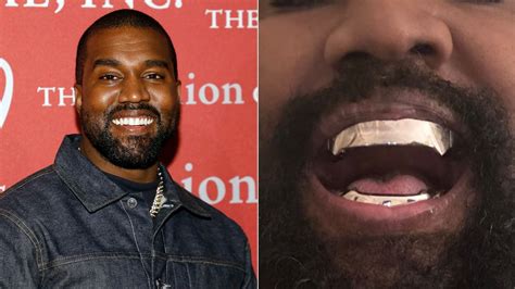 Celebrity Teeth Transformations Dramatic Before And After Photos