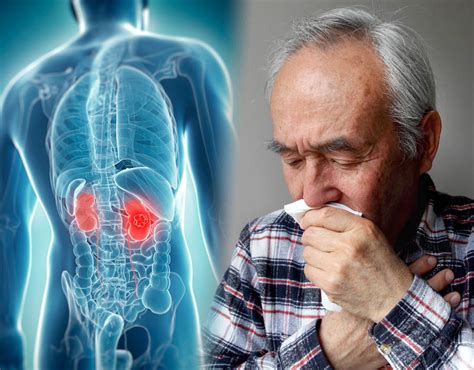 Cancer Kidneys Symptoms 5 Signs And Symptoms Of Kidney Cancer Learn