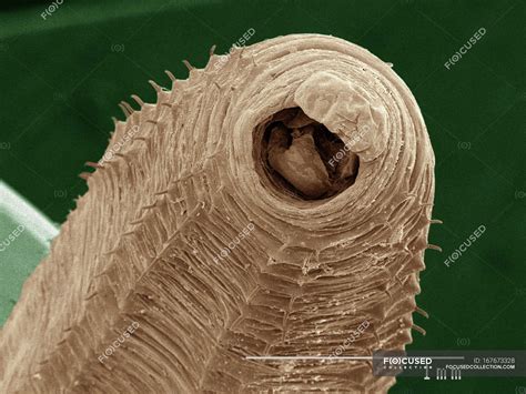 Earthworm Under Microscope