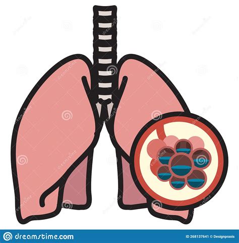 Human Lungs Pulmonary Edema Illustration Stock Illustration