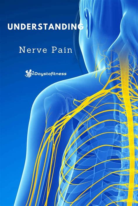 Understanding Nerve Pain Days To Fitness