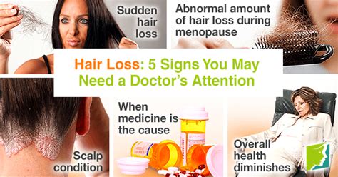 Hair Loss 5 Signs You May Need A Doctors Attention