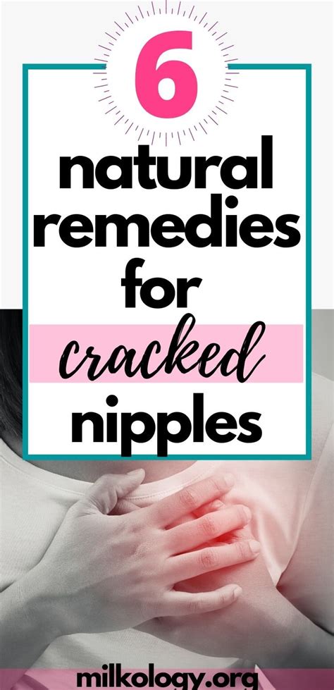 6 Home Remedies For Sore Cracked Nipples — Milkology®