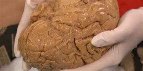 Watch Get An Up Close Look At A Real Human Brain Huffpost