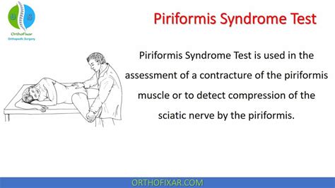 Piriformis Syndrome Test