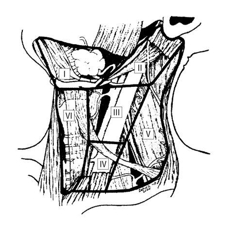 Neck Dissection Classification Update Oncology Jama Otolaryngology