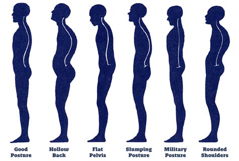 4 Easy Ways To Improve Your Posture A Must Read Goldenhitsmedia