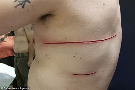 Tattoo Trend Sees Customers Asking For Scars Instead Daily Mail Online