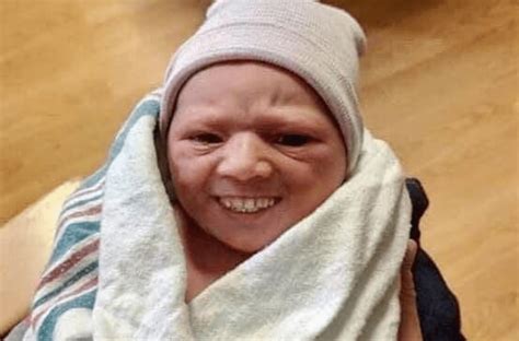 Disturbing Photos Of Babies With Grown Up Teethyouve Been Warned
