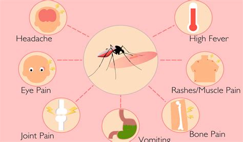 Dengue Its Causes Symptoms Prevention And Treatment Medical