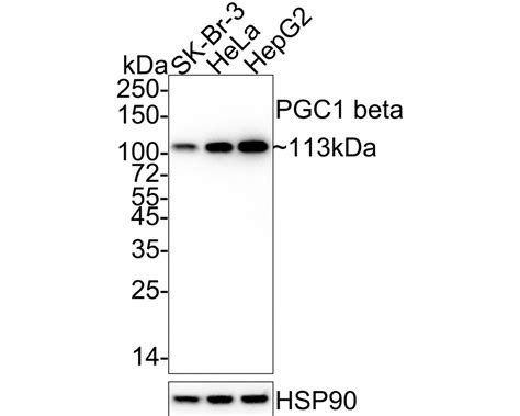 Pgc1 Beta Recombinant Rabbit Monoclonal Antibody Jm33 24 Et1705 65