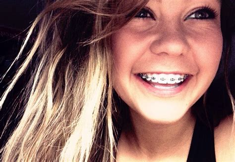 Girls With Braces On Twitter Courtney Phillips Awesome Braces