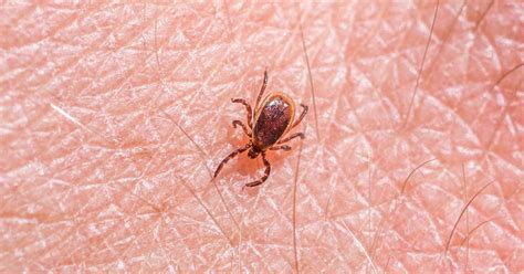 Tick Borne Disease Babesiosis Is On The Rise Cdc Says What To Know