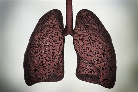 Le corps humain peut soigner par lui même des poumons endommagés par la